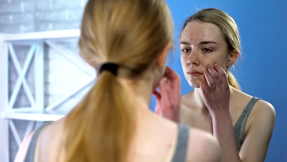 A young woman with acne on her face looks critically at herself in a mirror.  © Colourbox Photo: Ievgen Chabanov