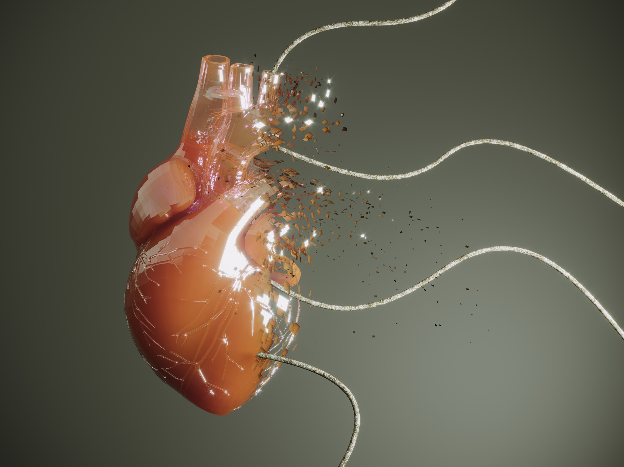 Heart Transplant Rejection Diagnostic Outperforms Biopsies