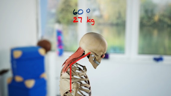 Schematic representation: When the head is bent forward at 60 degrees, 27 kilos pull on the neck muscles. © NDR 