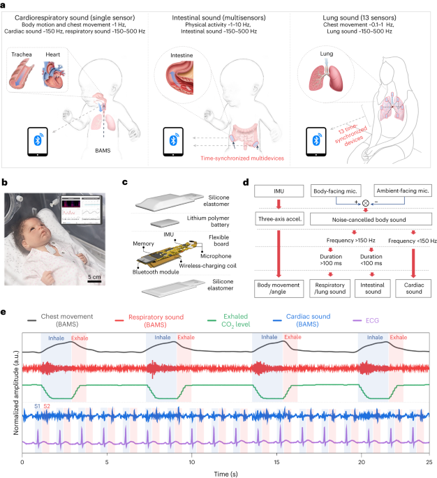 Wireless broadband acoustic-mechanical sensing system for continuous physiological monitoring