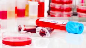 On a table in a laboratory there are Petri dishes and sample containers filled with blood samples.